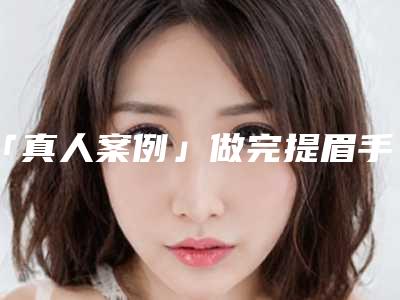 「真人案例」做完提眉手术,她即刻光彩焕发!